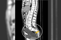 Ham trò mới mẻ khi ân ái, người đàn ông khiến bác sĩ sốc