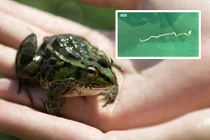 Co giật không rõ nguyên nhân, đi khám bác sĩ phát hiện chuyện ghê rợn