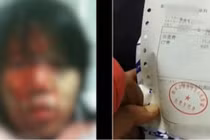 Bố chồng dùng xẻng đập vào đầu con dâu gây phẫn nộ