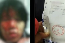 Bố chồng dùng xẻng đập vào đầu con dâu gây phẫn nộ