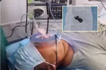 Ho nửa tháng không đỡ, phát hiện “quái vật” hút máu trong họng