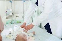 Bác sĩ tá hỏa phát hiện "thai nhi ký sinh" cực hy hữu