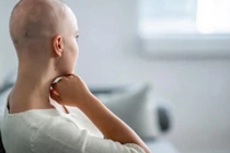 Lưỡi có 2 hiện tượng bất thường này, khám ung thư ngay 