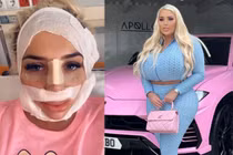 Cô gái phẫu thuật nâng ngực liên tục, bác sĩ cũng ám ảnh