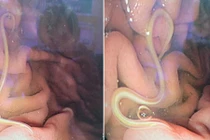 Cứ ăn món này là tiêu chảy, thanh niên trả giá vì sở thích 