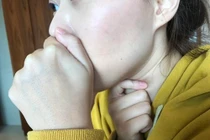 Lưỡi có dấu hiệu này, bác sĩ vô phương cứu chữa