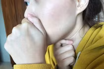 Lưỡi có dấu hiệu này, bác sĩ vô phương cứu chữa