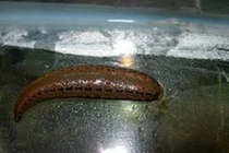 Dùng đỉa kích thích, người đàn ông khiến bác sĩ phát hoảng