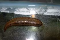 Dùng đỉa kích thích, người đàn ông khiến bác sĩ phát hoảng