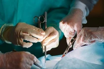 Bé trai tử vong sau cắt bao quy đầu, bác sĩ gây phẫn nộ