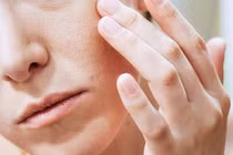 Nếu trên mặt xuất hiện 3 dấu hiệu này, bạn chắc chắn có vấn đề về gan 