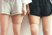Thường xuyên dùng tất thon chân, nữ giám đốc cầu cứu bác sĩ 