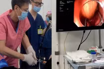 Bị táo bón, chàng trai thông ruột bằng cách kinh dị...nhập viện gấp