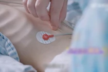 Để con gái tự do giảm cân, cha mẹ hối hận cả đời 