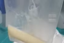 Thói quen khiến chàng trai nhập viện khẩn, máu chuyển màu trắng sữa