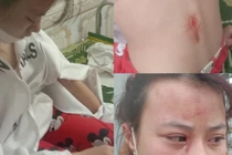 Hà Tĩnh: Khởi tố gã hàng xóm đánh nữ sinh lớp 10 chấn động não