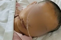 Vợ đệ đơn ly hôn, chồng trả thù dã man gây phẫn nộ 