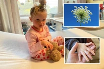 Dạo chơi hái hoa ngoài đường, bé gái khóc thét vì bỏng rát