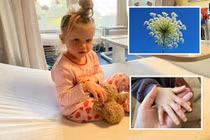 Dạo chơi hái hoa ngoài đường, bé gái khóc thét vì bỏng rát