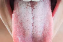 Tim khỏe hay không nhìn vào lưỡi sẽ biết ngay