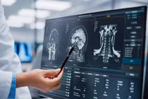 Đau bụng tiêu chảy liên tục, phát hiện chuyện ghê rợn trong não