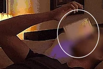 Dùng điện thoại trước khi đi ngủ, chàng trai suýt mù vĩnh viễn 