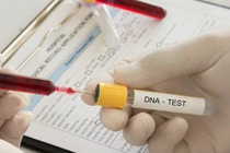 Xét nghiệm ADN, chồng đòi bỏ vợ và cái kết gây sốc 