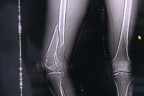 Tập yoga kiểu này, thanh niên suýt liệt luôn chân