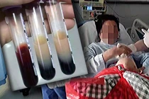 Ăn 10 đĩa thịt, bệnh nhân gây sốc vì máu chuyển màu trà sữa