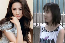 Phẫu thuật giống “thần tiên tỷ tỷ” Lưu Diệc Phi, cô gái sốc nặng