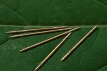 Nữ bệnh nhân đột quỵ, bác sĩ phát hiện chuyện ghê rợn