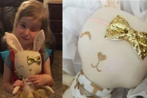 Cô bé mất mắt vì ung thư, điều người mẹ làm gây bất ngờ