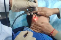 Chuyện lạ hãi hùng: Choáng váng cậu bé có cây mọc trong tai