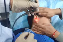 Chuyện lạ hãi hùng: Choáng váng cậu bé có cây mọc trong tai