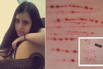 Chuyện lạ hôm nay: Cô bé tự rạch khắp cơ thể và nỗi đau phía sau