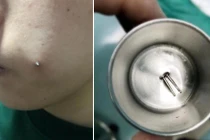 Mê lúm đồng tiền, gái trẻ đi làm điều lạ và kết rùng rợn...