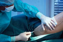 Số phận bi thảm của cô gái đầu tiên hút mỡ trong lịch sử