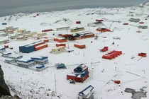 Chuyện lạ hôm nay: Lạ nơi muốn đến sống phải... cắt bỏ ruột thừa