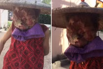 Xót xa người phụ nữ có "mặt quỷ", bị buộc ngủ với chó