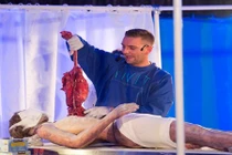 Ghê rợn cảnh giải phẫu người trước bữa ăn tối ở Anh