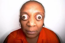 Kỷ lục thế giới dành cho những phần cơ thể dị nhất