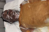 Giành tiếp viên karaoke, người đàn ông bị tưới xăng thiêu sống