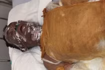 Giành tiếp viên karaoke, người đàn ông bị tưới xăng thiêu sống