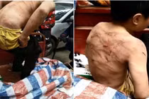 Cậu bé “đông cứng” nấp trên xe và sự thật nhói lòng 