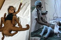 Cô bé 4 chân 4 tay như “nữ thần chuyển thế” và cái kết