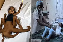 Cô bé 4 chân 4 tay như “nữ thần chuyển thế” và cái kết