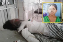 Từ chối lời cầu hôn, cô gái bị tưới dầu hoả, thiêu sống 