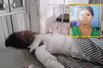 Từ chối lời cầu hôn, cô gái bị tưới dầu hoả, thiêu sống 