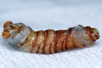 Kinh hoàng những động vật nhầy nhụa trong cơ thể người (1)