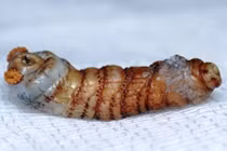 Kinh hoàng những động vật nhầy nhụa trong cơ thể người (1)